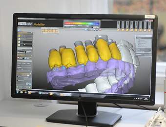 Einzug der digitalen Zahnmedizin