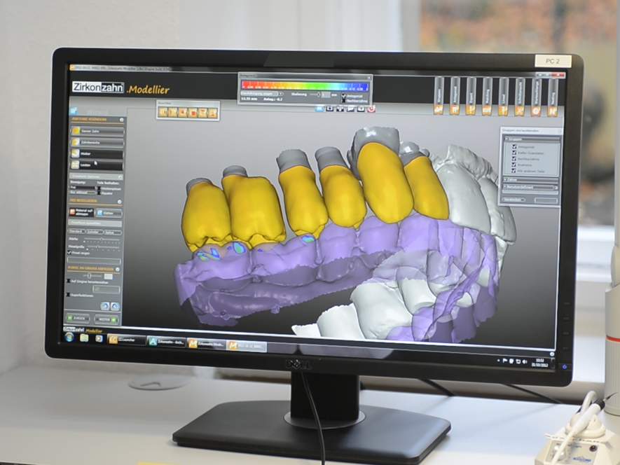 Einzug der digitalen Zahnmedizin