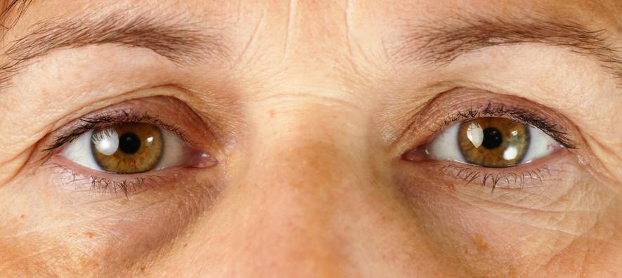 Auf den ersten Blick – Die Augen und was sie über Krankheiten verraten