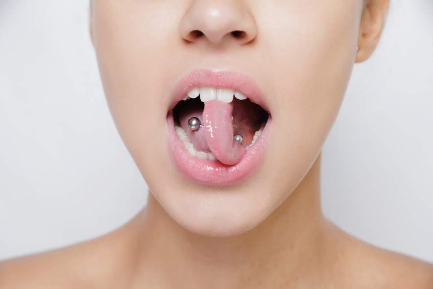 Studie: Zusammenhang zwischen Zungen- und Lippenpiercings und Parodontitis